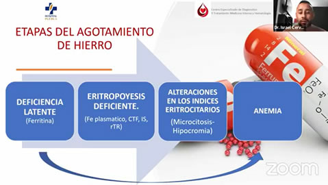 Anemia por deficiencia de hierro